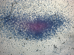 Projection d'ascospores de Venturia asperata (pic du 27.04.2009 au CTIFL Lanxade, 24)